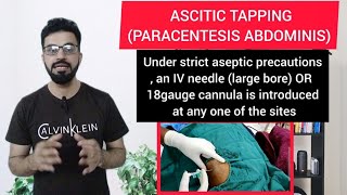 Ascitic Tapping OR Paracentesis Abdominis  Procedure  DRY TAP  Indication  Complication [upl. by Nnaed47]