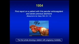 Antiphospholipid syndrome [upl. by Intisar]