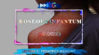 ROSEOLA INFANTUM  DrAREEJ  LECTURE 5 [upl. by Valry422]