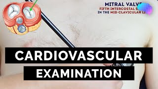 Cardiovascular Examination  OSCE Guide  UKMLA  CPSA [upl. by Elletnohs]