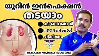 URINE INFECTION UTI MALAYALAM യൂറിൻ ഇൻഫെക്ഷൻ തടയാം  ലക്ഷണങ്ങൾ കാരണങ്ങൾ ചികിത്സ  Dr Nazer [upl. by Ingrim]