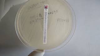 MIC of Vancomycin Determination for Staphylococcus aureus using Epsilometer I E Test Strip [upl. by Nanette]