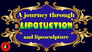 A journey through liposuction and liposculpture Part 410 [upl. by Nahsar547]