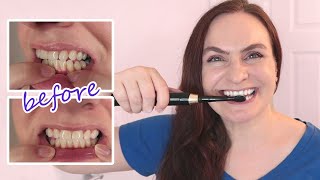 Will this Work WHITER Teeth  Healthy Gums Naturally [upl. by Savell]