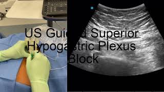 Ultrasound Guided Superior Hypogastric Plexus Block [upl. by Ycnuahc856]