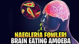 Naegleria Fowleri Brain Eating Amoeba [upl. by Nirac170]