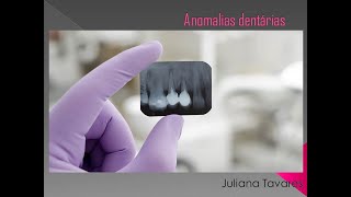 Anomalias dentárias [upl. by Einahc]