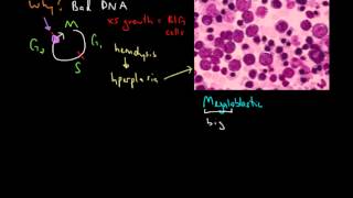 Macrocytic Anemia [upl. by Stavros]