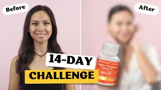 Watch the dAlpha Tocopherol Myra E 14Day Challenge [upl. by Nerw295]