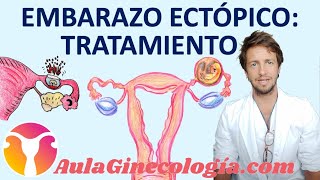 TRATAMIENTO del EMBARAZO ECTÓPICO METOTREXATO SALPINGUECTOMÍA  Ginecología y Obstetricia [upl. by Ynaffad]