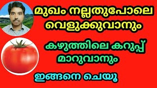 മുഖം നല്ലതുപോലെ വെളുക്കാനും  കഴുത്തിലെ കറുപ്പ് മാറാനും  ഇങ്ങനെ ചെയൂ  Face Whitening [upl. by Strephon]