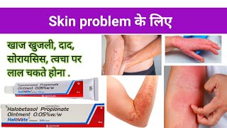 Halobetasol propionate Benefits Dosage in Hindi  जाने सम्पूर्ण जानकारी इन हिन्दी  कैसे इस्तेमाल [upl. by Rednav]