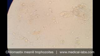 Chilomastix mesnili Trophozoites [upl. by Moreville]