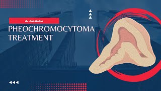 Pheochromocytoma Treatment [upl. by Aela]