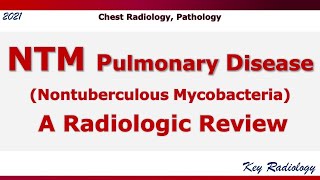 NTM Pulmonary Disease A Radiologic Review [upl. by Bray716]