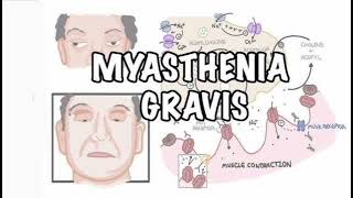 Myasthenia gravis History mrcpch Clinical [upl. by Ayikahs]