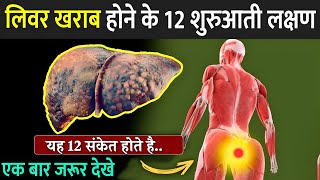 लिवर खराब होने में 12 शुरुआती लक्षण  12 Weird Signs Of Liver Damage  Liver Damage Signs In Hindi [upl. by Lammond303]