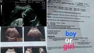 Baby Gender prediction using scanning reportplacenta positionFHRboy and girl scanning r Malayalam [upl. by Nara196]