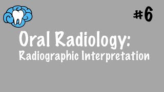 Oral Radiology  Radiographic Interpretation  INBDE ADAT [upl. by Latterll]