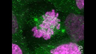 Microtubule dynamics in a dividing cell [upl. by Zacherie213]