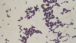 Gram staining of Enterococcus [upl. by Earl732]