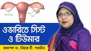 Ovarian Cyst  ওভারিয়ান সিস্ট এর চিকিৎসা  Ovarian cysts signs and symptom Ovarian tumortreatment [upl. by Shaefer]