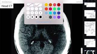 Neuropathology [upl. by Lavinie938]