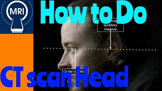 How to do CT scan Head [upl. by Hedwig991]