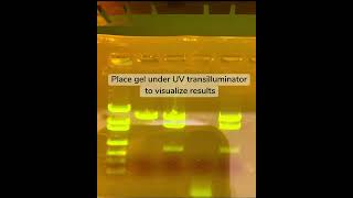 Gel Electrophoresis [upl. by Arimay]