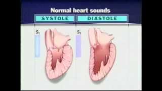 Auscultation of Heart Sounds Part1  Listening to Heart Sounds [upl. by Wan]