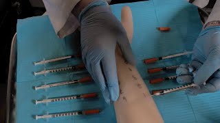 ASMR Hospital Allergy Testing  Intradermal Test Skin Exam [upl. by Merill13]