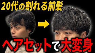 【20代の薄毛対策】前髪のM字が薄く、割れて見えないコツ！ [upl. by Mercado615]