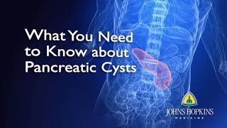 What You Need to Know About Pancreatic Cysts [upl. by Kiefer]