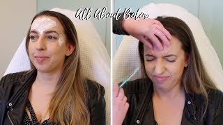 All About Botox 💉 Crows Feet Forehead 11 Before amp After Photos Does It Work Cost Review [upl. by Yellat]