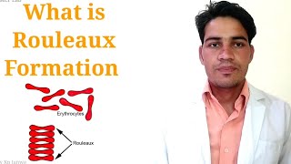 What is Rouleaux formation rouleaux formation in hindi [upl. by Ellessig794]