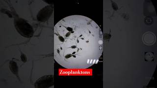 Identification of Zooplankton 😍 under Microscope🔬 plankton shorts aquaculture farming ytshorts [upl. by Eimarej]