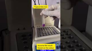 wait for end for triglycerides test tryglycerides lipidprofile lipidscience themltnk [upl. by Tebzil]