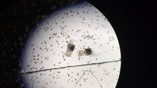 Under a microscope zooplankton eat phytoplankton [upl. by Aiker]