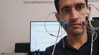 Facial palsy EMG biofeedback system to retrain zigomaticus major muscle smile [upl. by Giliane]