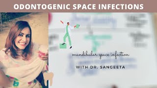 space infection in mandible I oral surgery lecture [upl. by Erminna]