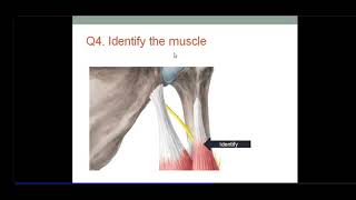 Muscles of Upper Limb  Self Assessment Test with Explanation by Dr SAM [upl. by Arst]