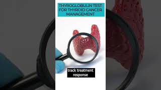 Discover the Thyroglobulin test amp its role in thyroid cancer detection and management thyroidcancer [upl. by Eserehs]