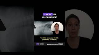 ¿Líquido en los pulmones Efusión pleural y edema pulmonar [upl. by Kutchins]