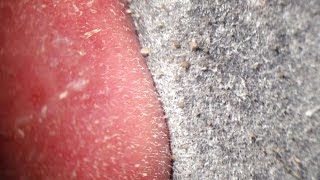 Pore Strips removal close up Blackheads removal [upl. by Ilatfan]