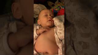 Example of Retractions Belly Breathing and Tachypnea in Infant [upl. by Anoo]