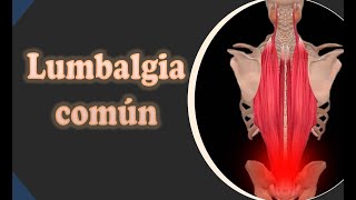 Lumbalgia común [upl. by Nodnorb]