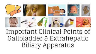 Clinical anatomy of gallbladder and extrahepatic biliary apparatus gallbladder clinicalanatomy [upl. by Armand]