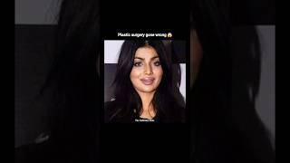 Celebrities plastic surgery has gone wrong but not aditys 😍😱 shortsfeed shorts viral trending [upl. by Womack]