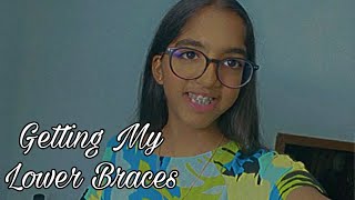 Get My Lower Braces 😁 isajaneparadise youtube tiktok braces bracescolors [upl. by Yuri]