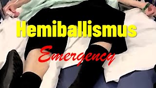 Hemiballismus Emergency [upl. by Alyam]